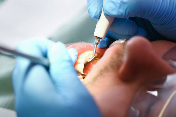Best 24-Hour Dental Clinic Near Me  in Ballville, OH