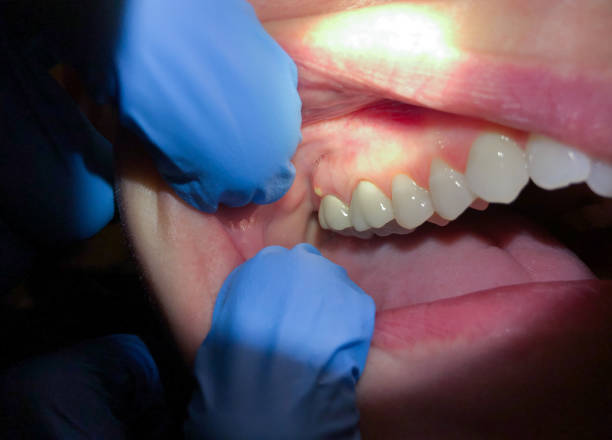 Best Walk-In Dentist Near Me  in Ballville, OH