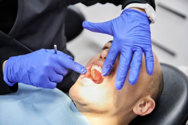 Best Dentist for Tooth Abscess  in Ballville, OH